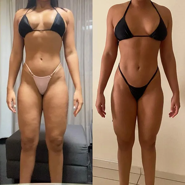 Client before-and-after result